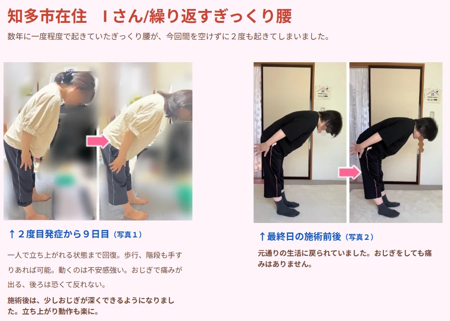 繰り返すぎっくり腰の症例